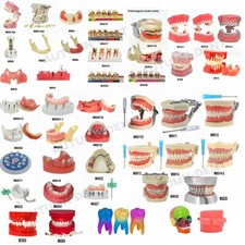 Dentale Typodont Modello Denti