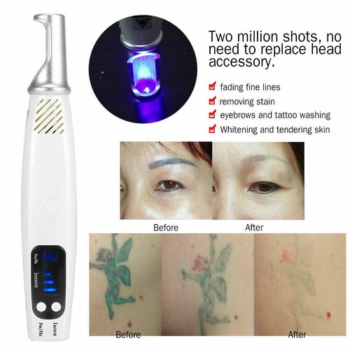 Penna laser picosecondi