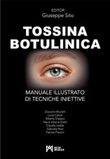 Tossina botulinica Giuseppe