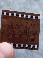 NEGATIVO FOTOTIFO ULTRAS