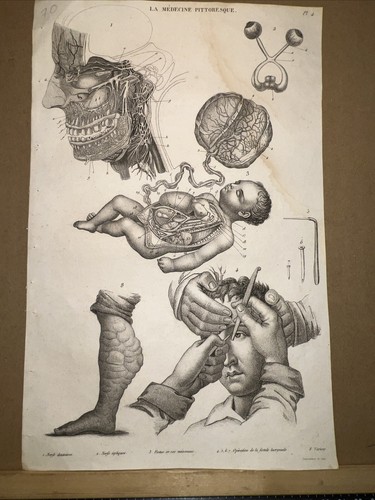 Stampo antico 1834 - , anatomia