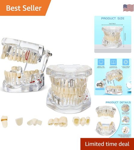 Modelli denti trasparenti 2 - denti,