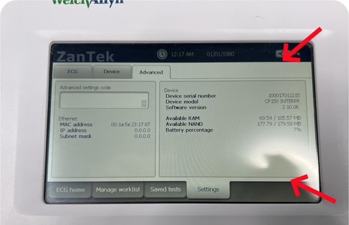 Schermo display lcd - display,