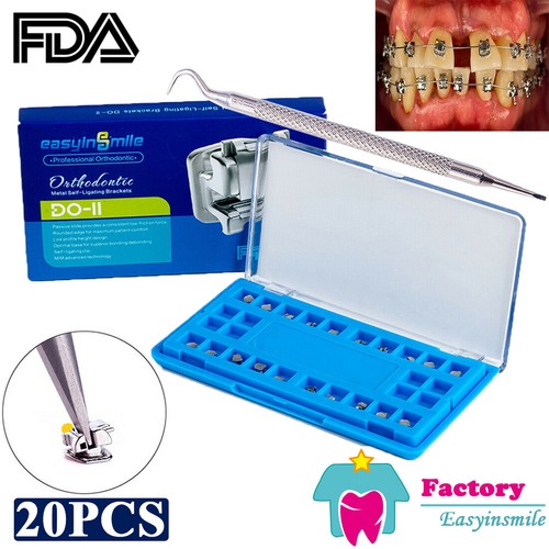 Staffe ortodontiche dentali
