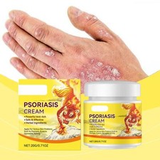 Psoriasis Cream Dermatitis Pruritus Eczema Ointment Skin Anti Itching.,,`.;'/