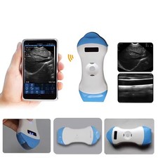Portable Wireless Ultrasound