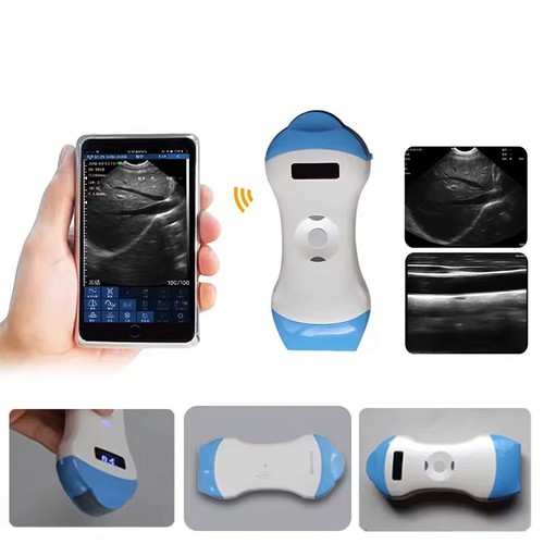 Scanner ultrasuoni wireless - scanner,