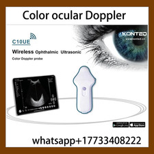 Sonda Doppler a colori