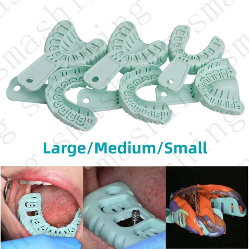 Impianto ortodontico dentale