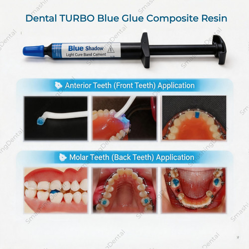 Dentale turbo colla blu - blu, resina