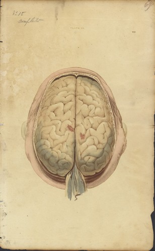 Cervello dal vero - vero,, acquaforte