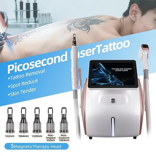 Depilazione laser diodi in - depilazione, 2