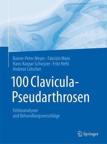 100 clavicula pseudarthrosen - 100,