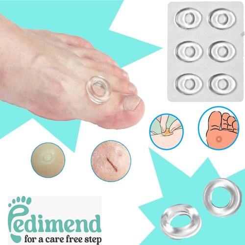 Pedimend anelli gel - anelli,