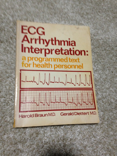 Ecg arrhythmia interpretation - ecg,
