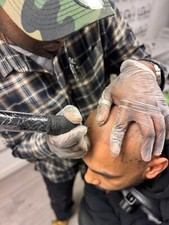 Soluzione Perdita Capelli - Micropigmentazione Cuoio Capelluto - Soluzione Perdita Capelli Uomo - SMP