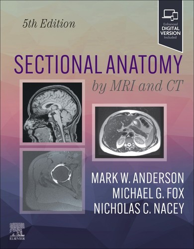 Sectional anatomy mri and - sectional,