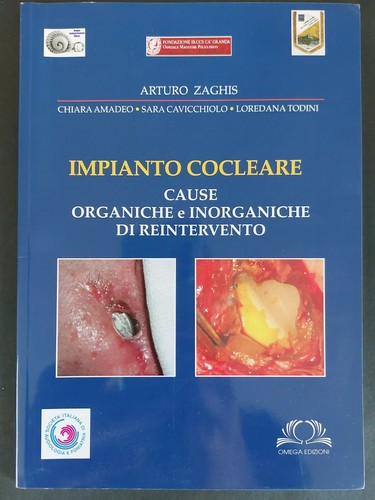 Libro impianto cocleare - l',