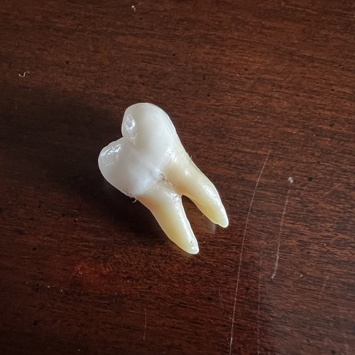 Dente umano molare - un,
