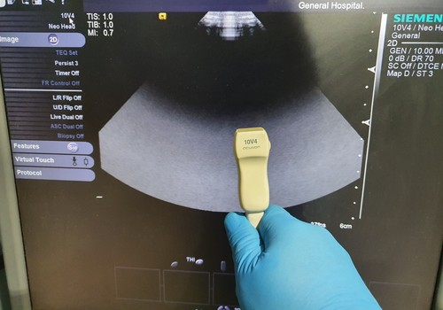 Trasduttore sonda ultrasuoni - sonda,