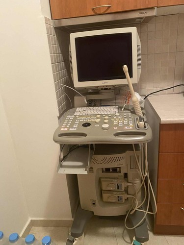 Sonda transvaginale aloka - sonda,