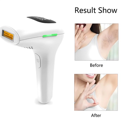 Epilatore laser ipl - epilatore,