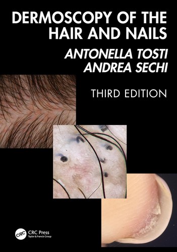 Dermoscopy the hair - the, and