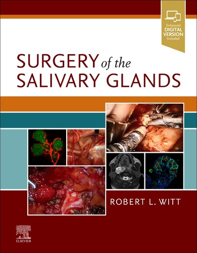 Surgery the salivary glands - the,