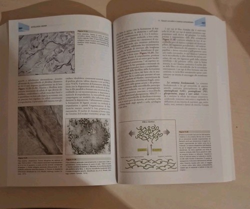 Idelson gnocchi istologia - gnocchi,