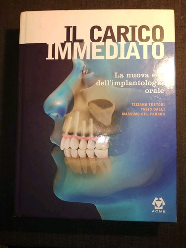 Carico immediato nuova - immediato, la