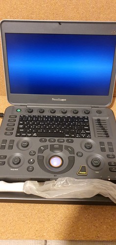 Ecocardiografo sonoscape - ecocardiografo,