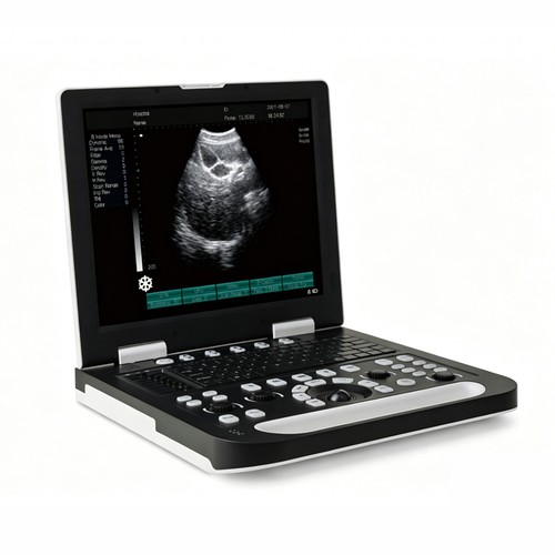 Scanner ultrasuoni doppler - ultrasuoni,