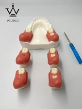 Estrazione Denti Impatto
