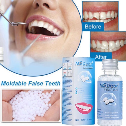 Kit riparazione denti - denti, perline