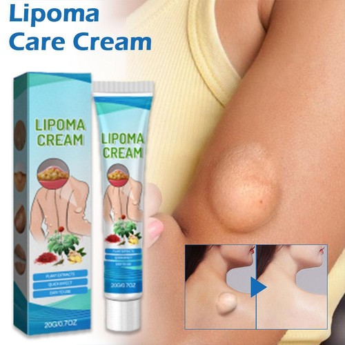 20g lipoma crema lenitiva - 5x,