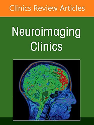 Neuroimaging anatomy part - part, 2