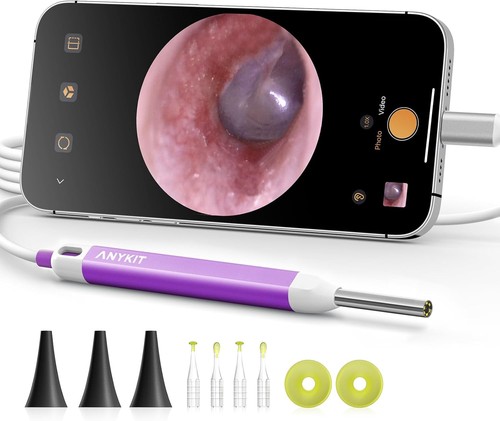 Nuovo anykit otoscopio - nuovo,