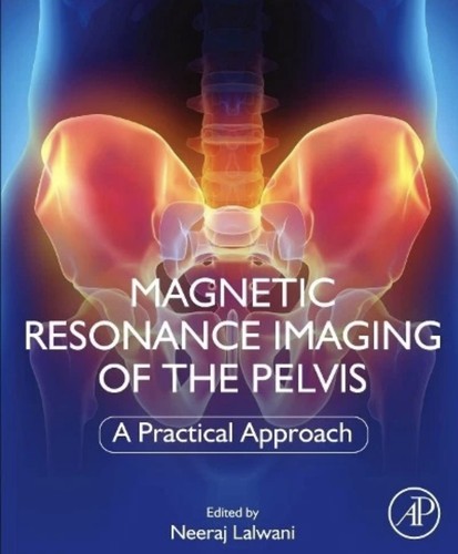 Magnetic resonance imaging - magnetic,