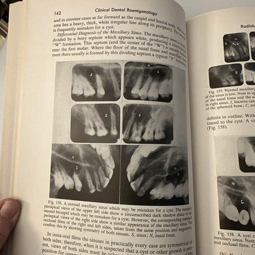 Old ray book - x-ray, clinical