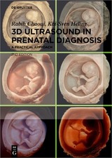 3D Ultrasound in Prenatal