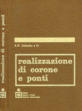 Realizzazione di corone e