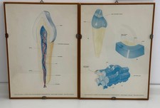 Coppia di tavole anatomiche vintage – Anatomia del dente umano
