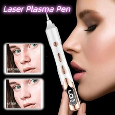 Penna al plasma laser per