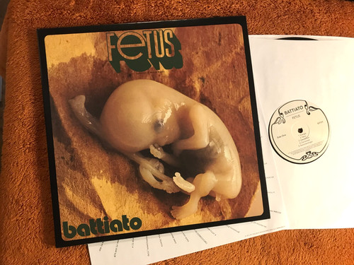 Fetus battiato superior - fetus,