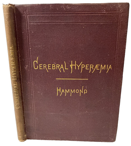 Cerebral hyperaemia mental - cerebral,
