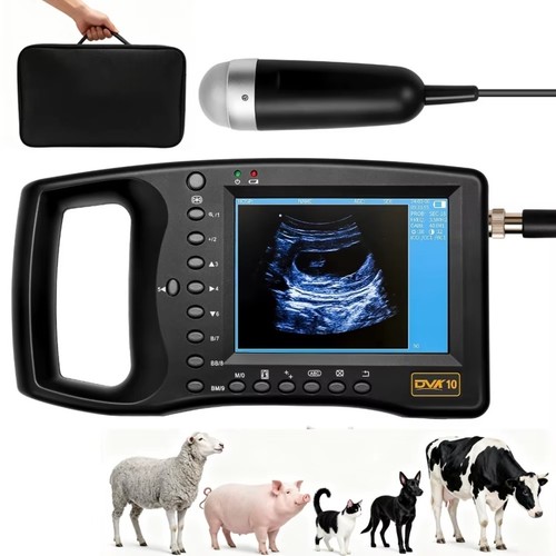 Scanner ultrasuoni - scanner,
