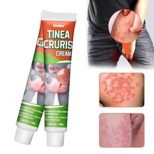 30G Tinea Cruris unguento