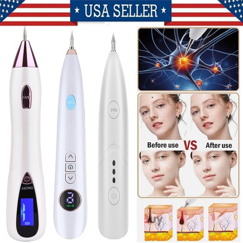 Penna elettrica laser