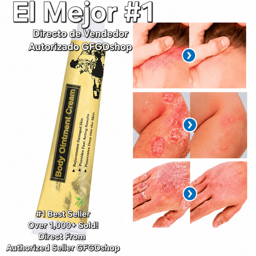 Crema para dermatite eczema - dermatite,
