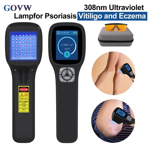 Lampada fototerapia uvb 308nm - fototerapia,